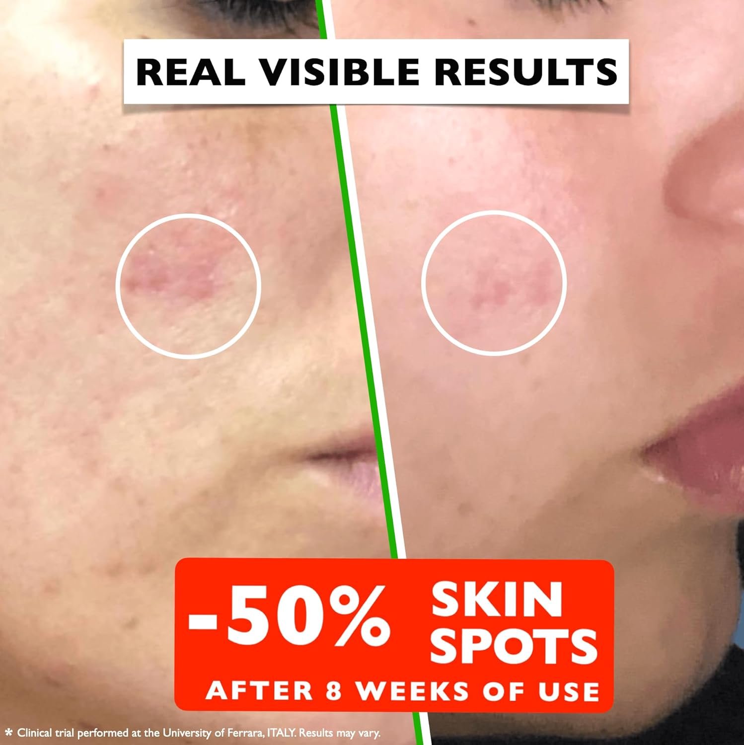 Vitamin C Serum For Face – Anti Aging Face Serum with Vitamin C, Hyaluronic Acid, Vitamin E. Brightening Formula. Improve Appearance of Dark Spots, Tone, Fine Lines & Wrinkles, Glowing Skin 2 Fl Oz - Image 4