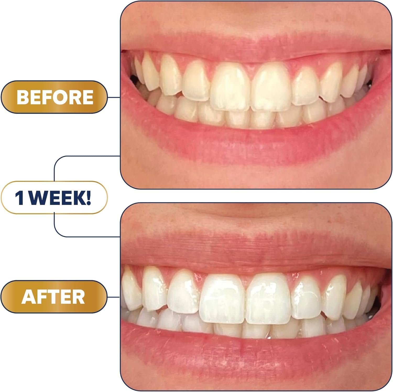Lumineux Teeth Whitening Strips Kit - 9 Treatments (1 Month) - Peroxide Free - Enamel Safe for Whiter Teeth - Whitening Without The Sensitivity - Dentist Formulated - Sensitivity Free - Image 5