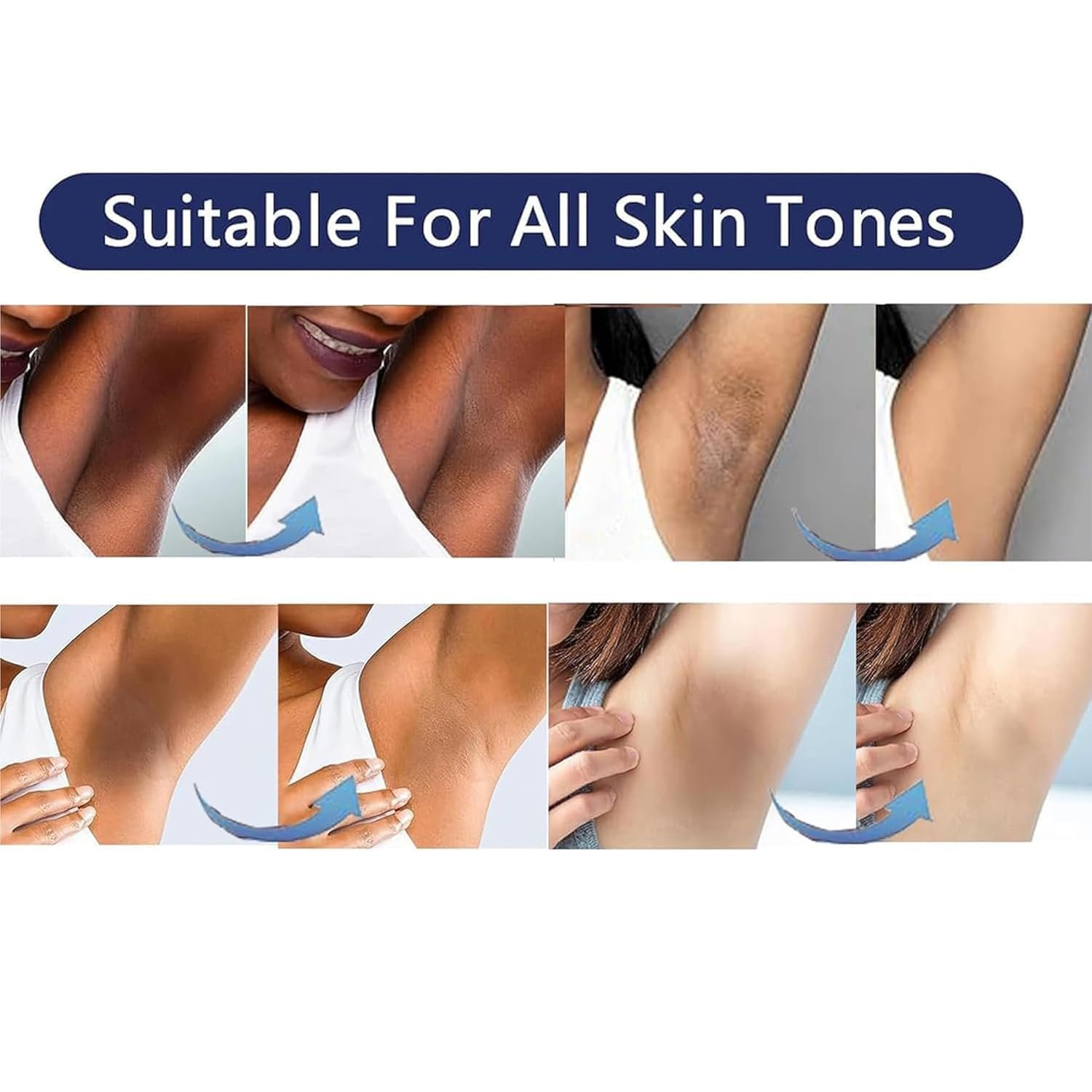 Skin Lightening Cream Gel For Body Intimate Area With Niacinamide, Arbutin, Vitamin C For Private Parts, Underarm, Knees, Elbows, Inner Thigh, Bikini Areas, armpit Skin Whitening Bleaching Cream 30ML - Image 2