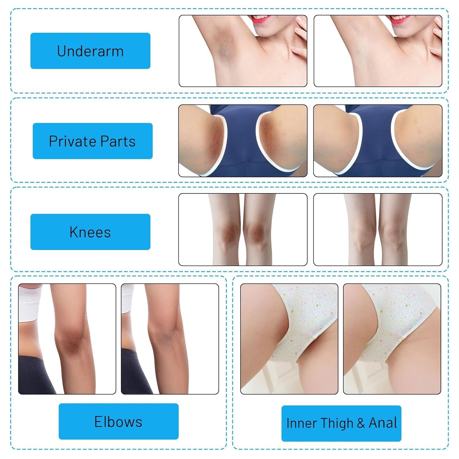 Skin Lightening Cream Gel For Body Intimate Area With Niacinamide, Arbutin, Vitamin C For Private Parts, Underarm, Knees, Elbows, Inner Thigh, Bikini Areas, armpit Skin Whitening Bleaching Cream 30ML - Image 5