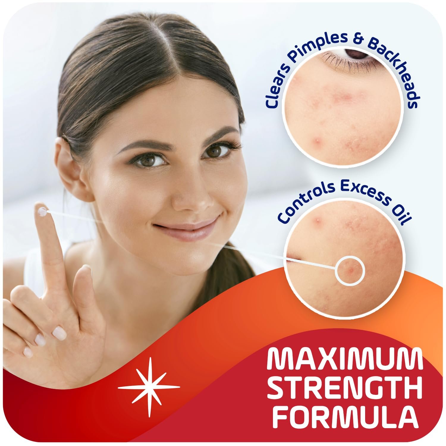 Asepxia 2% Salicylic Acid Acne Spot Treatment Cream | Drying Formula Targets Acne, Clears & Prevents Blemishes, Reduces Redness, Penetrates Pores, Pimple Cream, 1 Oz, 1-Pack - Image 3