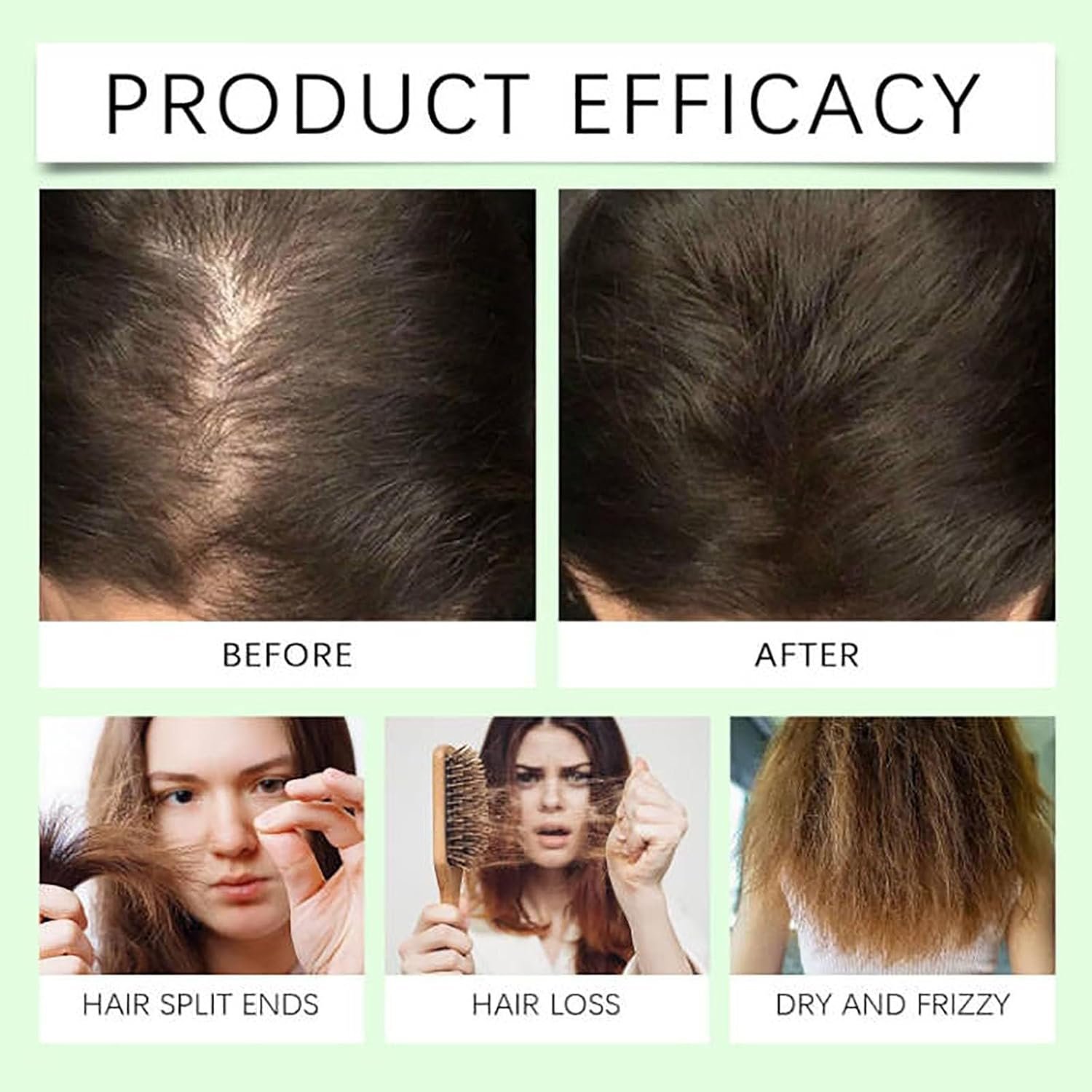 Anti-Hair Fall Hair Loss Shampoo, Anti-Hair Fall Promote Hair Growth Shampoo for Women Men, Moisturizing Suitable for All Hair Types 10.56 FL OZ (300ml) - Image 2