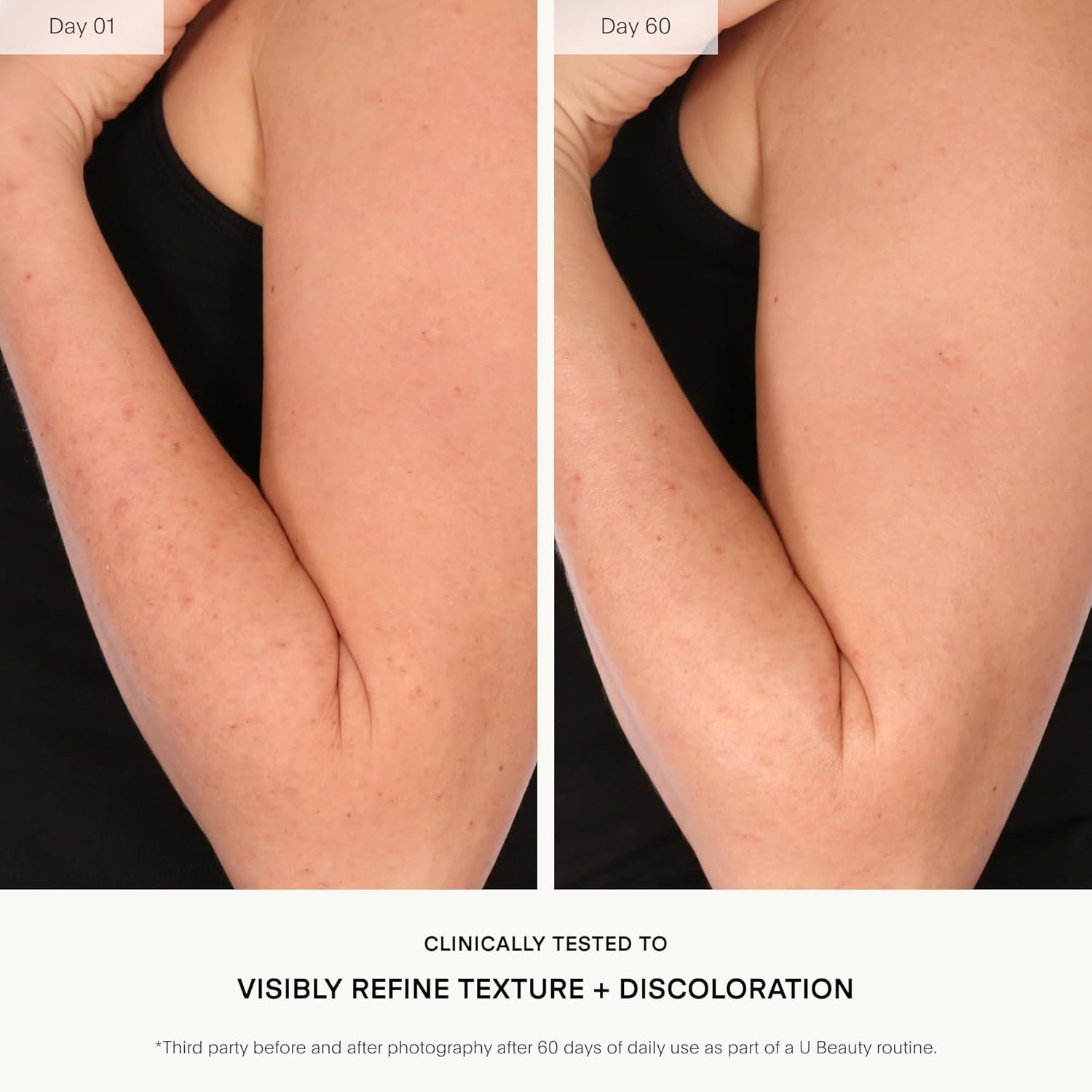 U Beauty Resurfacing Body Compound - Firming AHA & Retinol Serum, Phytic, Lactic & Glycolic Acids Tackle Keratosis Pilaris & Uneven Texture - Shea Butter & Papain for Hydrated Soothed Skin - 6.7 Fl Oz - Image 4