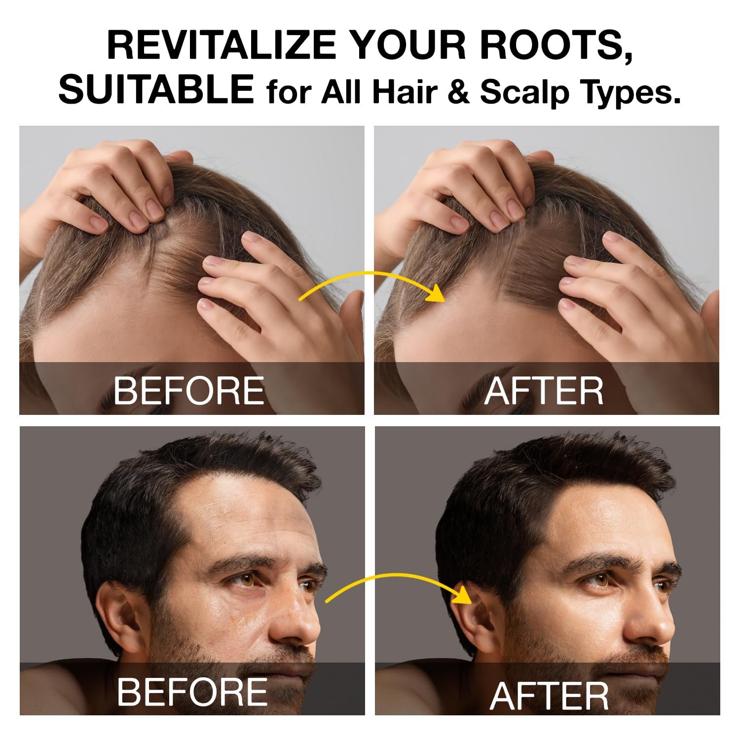 Root Activator Shampoo for Men: Hair Growth Shampoo for Hair Loss and Thinning Hair - 10.1 fl oz / 300 mL - Image 4