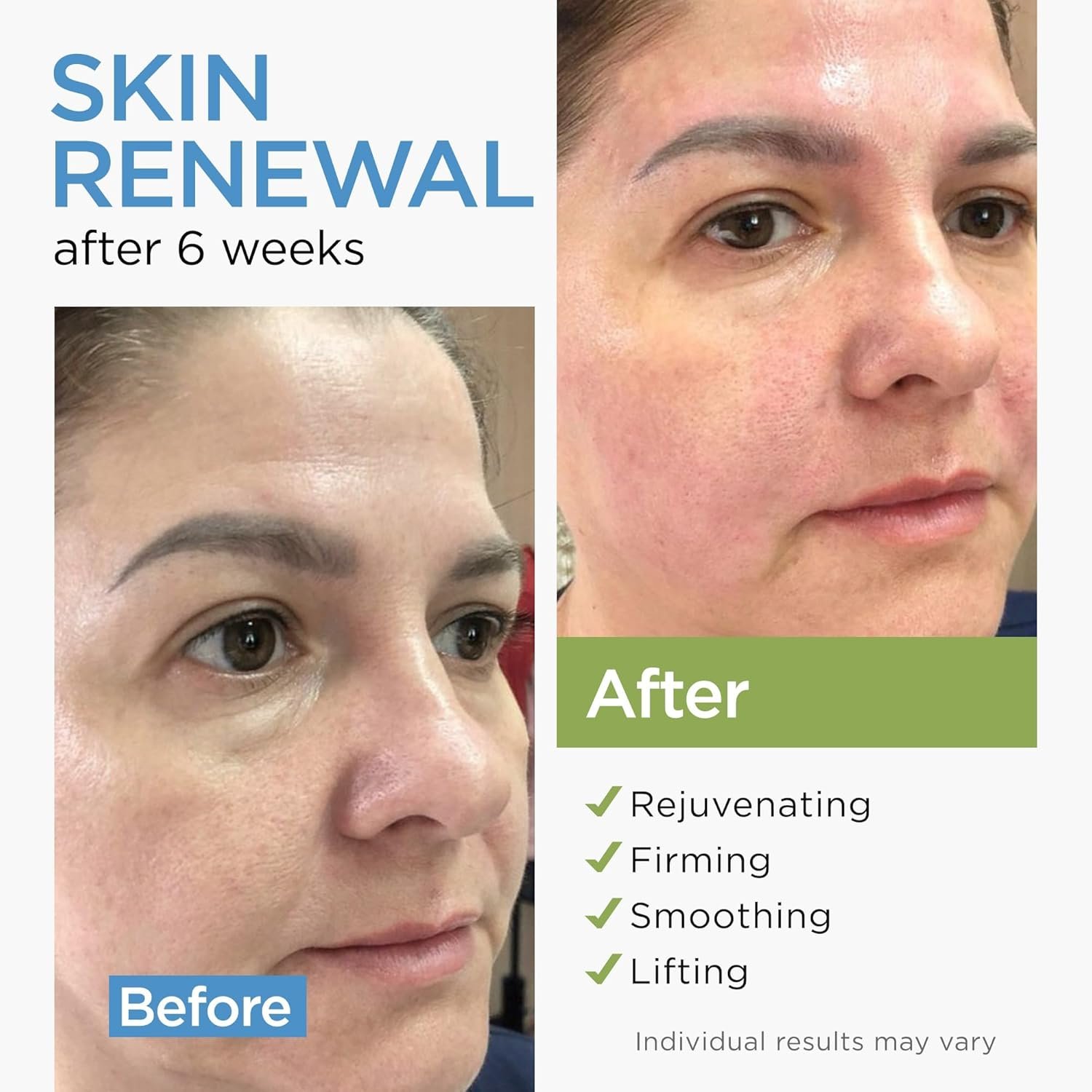 Moisturizer Collagen Anti-Aging Face Cream with Stem Cells, Retinol, Hyaluronic Acid & Niacinamide - Hydrating Day & Night Wrinkle Cream for All Skin Types - Airless Pump - Made in USA - 1.7Oz - Image 2