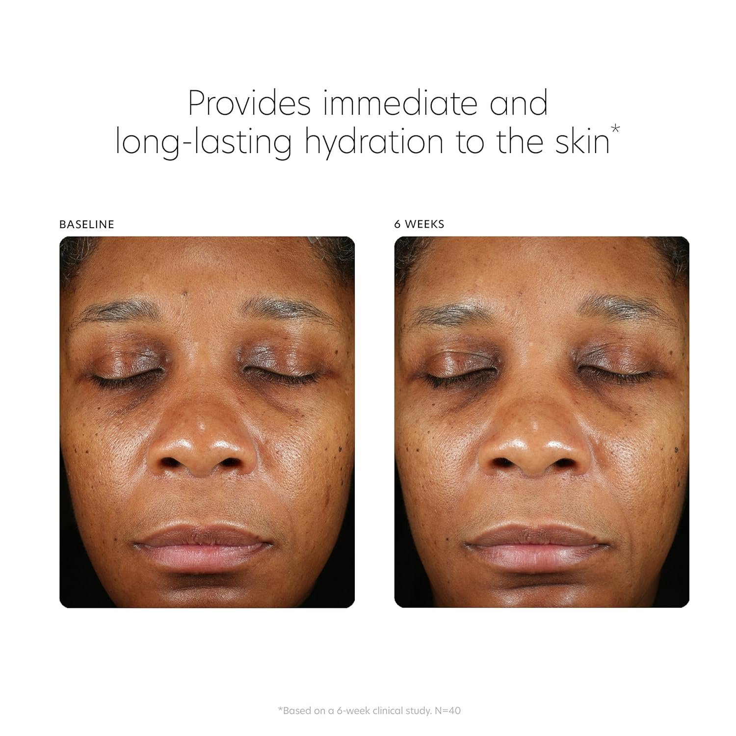 PCA SKIN Hyaluronic Acid Boosting Face Serum, Hyaluronic Acid Serum for Face Made with Niacinamide and Ceramides, Helps Reduce Fine Lines and Wrinkles and Delivers 24-Hour Moisturization, 1 oz Pump - Image 9