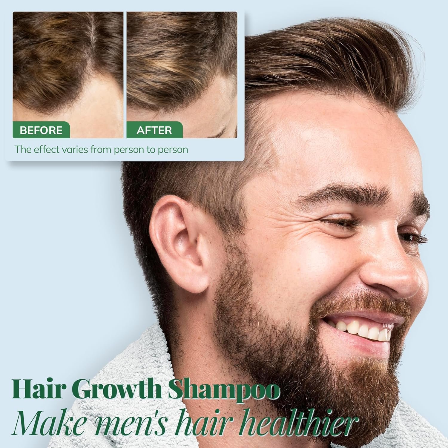 Hair Growth Shampoo with Rosemary and Biotin - Hair Thickening & Hair Loss Shampoo for Men and Women, Sulfate & Paraben-Free Scalp Care for All Hair Types(12.8 Fl Oz) - Image 4