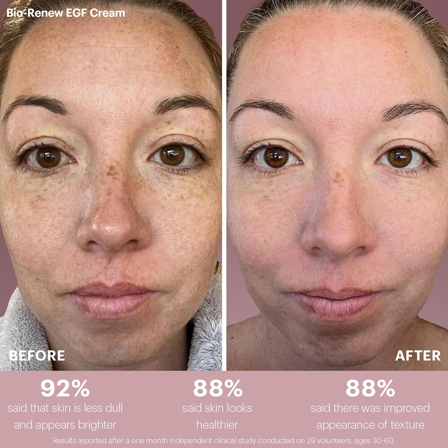 Glo Skin Beauty Bio-Renew EGF Discovery Set ($196 Value) – Travel Size Anti-Aging Skincare Kit for Hydration, Smoothing & Skin Renewal - Image 6