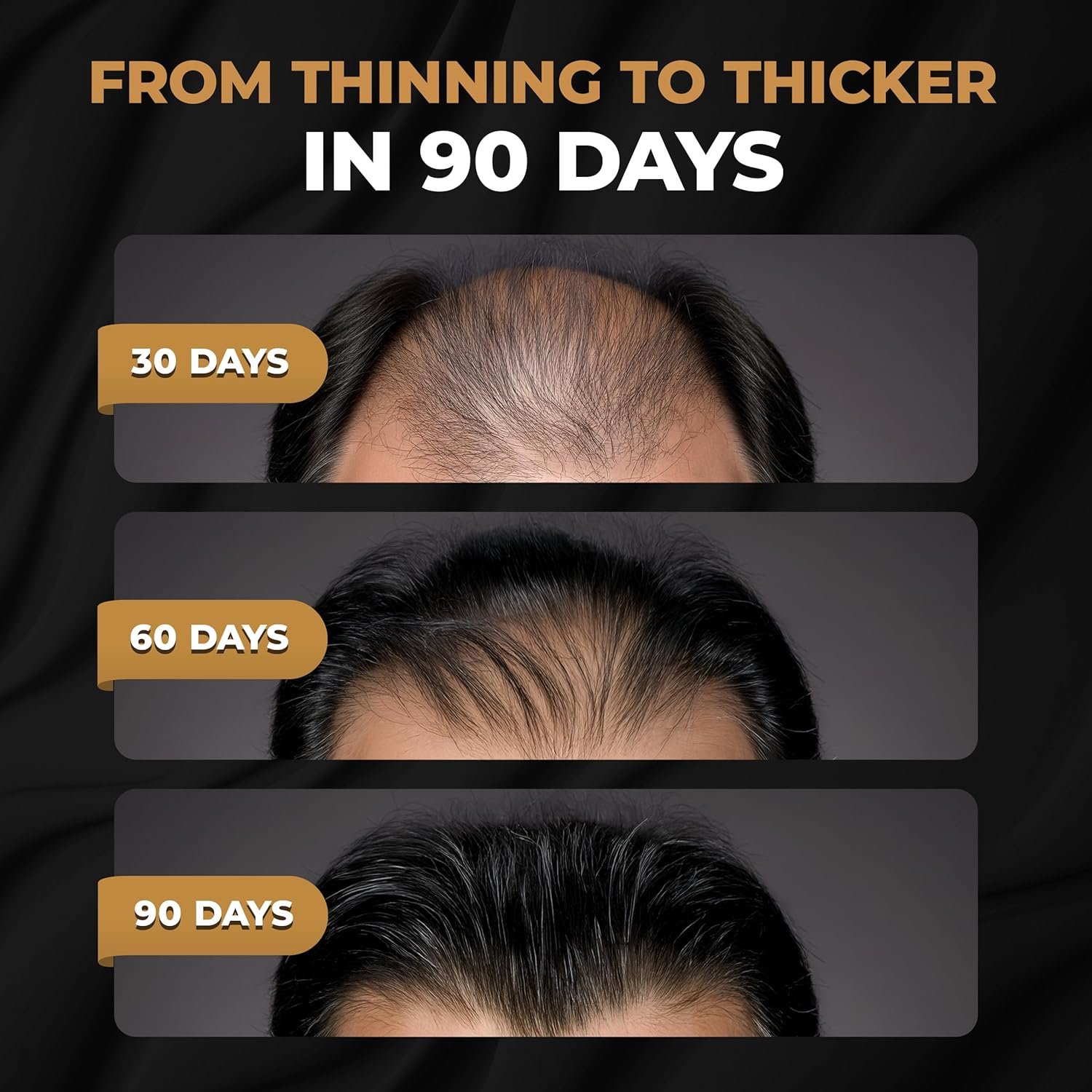 SPARTAN™ Root Activator Shampoo For Men - Hair Growth Shampoo for Hair Loss and Thinning Hair - Image 2