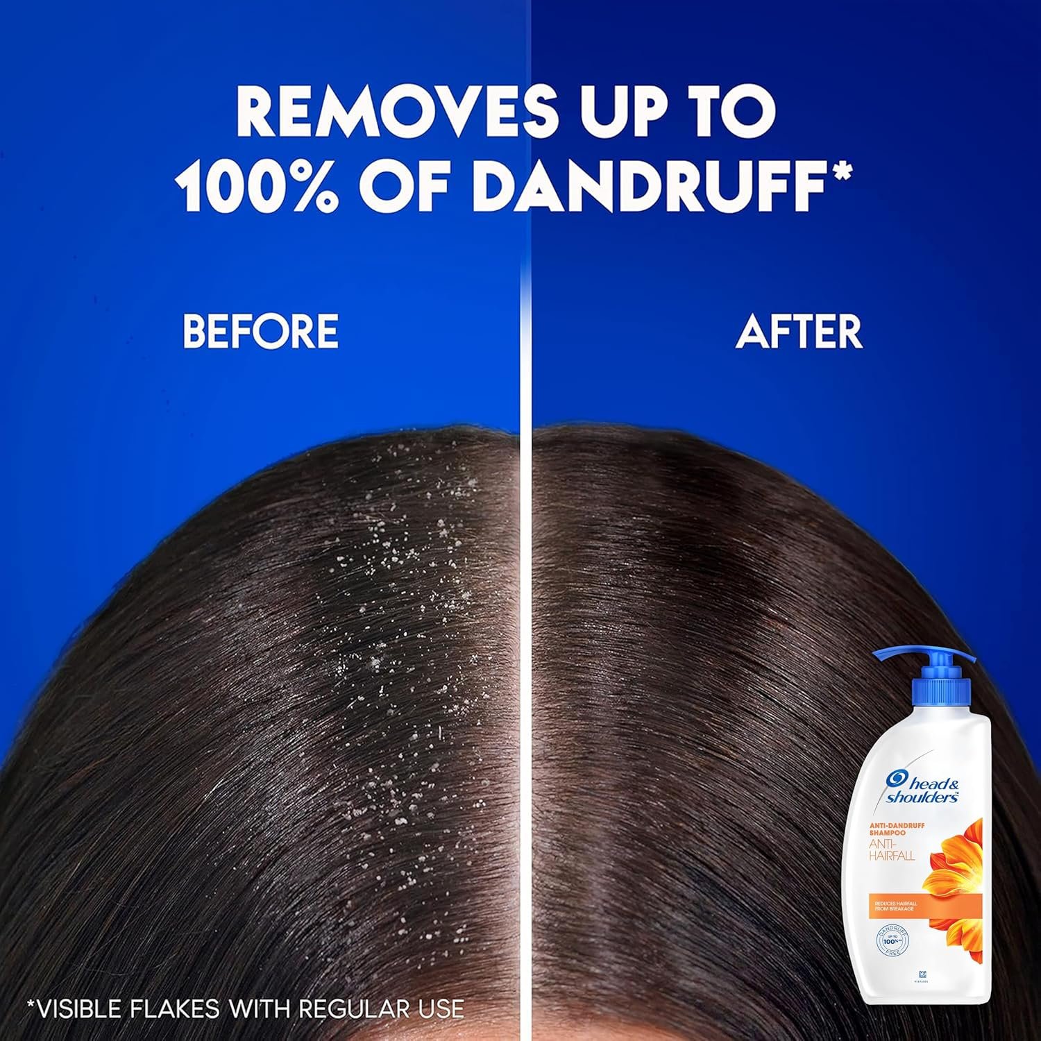 Head & Shoulders Anti Hair fall Shampoo, 2 Pack Anti Dandruff Shampoo, Relieves Dry Scalp and Repairs Damage, Fresh Scent, 22 oz Pump Bottles - Image 8