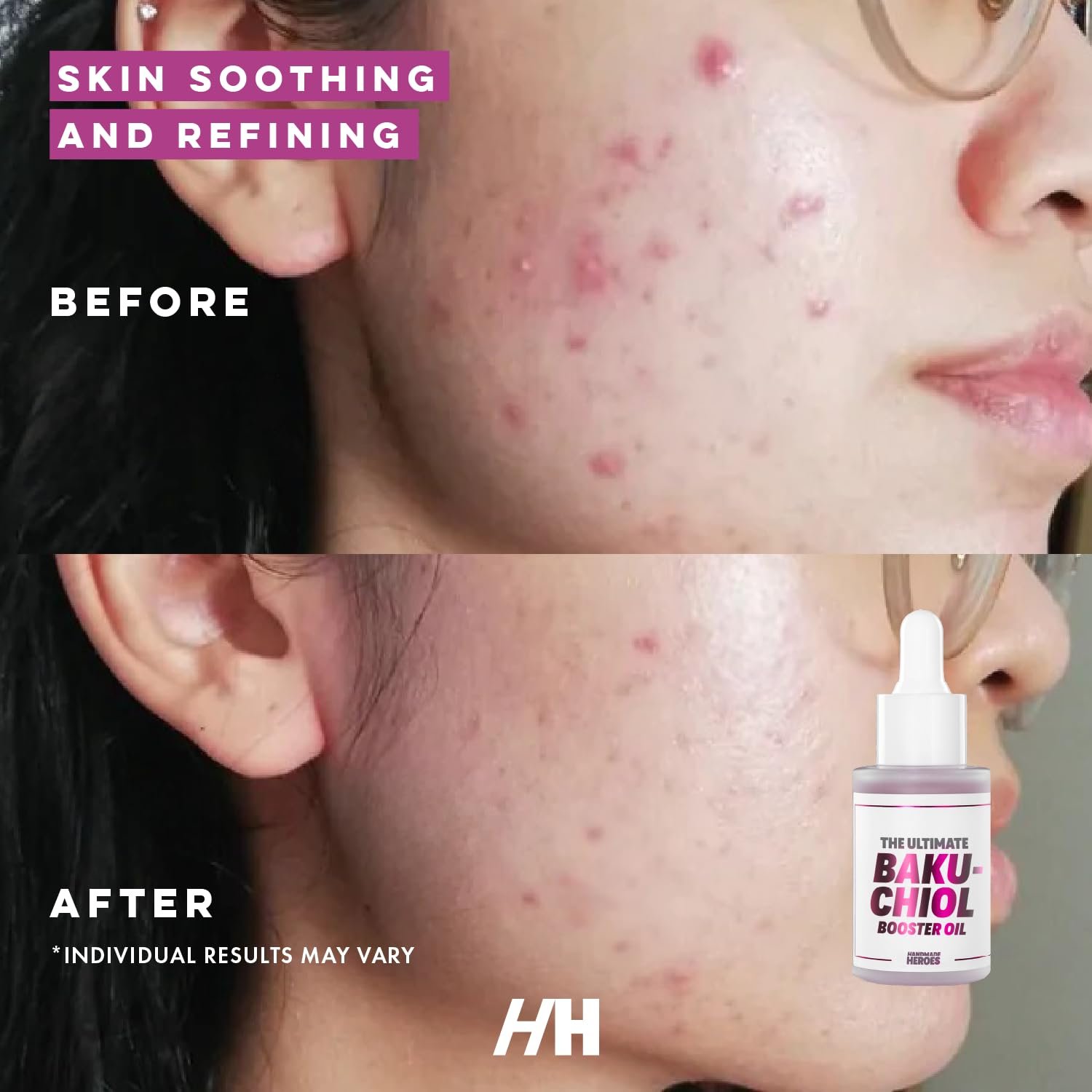 Handmade Heroes 2% Bakuchiol Oil Lifting and Firming Oil for Guasha Neck, and Décolleté, All Natural Retinol Alternative For Radiant and Line Smoothing 0.75oz - Image 2