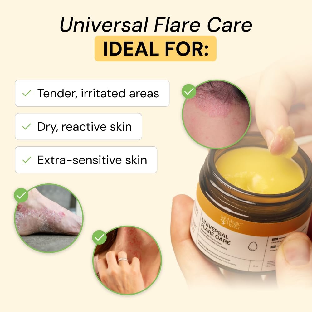 MyMagicHealer Universal Flare Care | Essential Oil Free | Baby Dermatitis, Diaper Rash, Eczema, Psoriasis, Impetigo | Wound Care | Multi-purpose Solution for Sensitive Skin w/ Propolis & Egg Yolk 4 oz - Image 2
