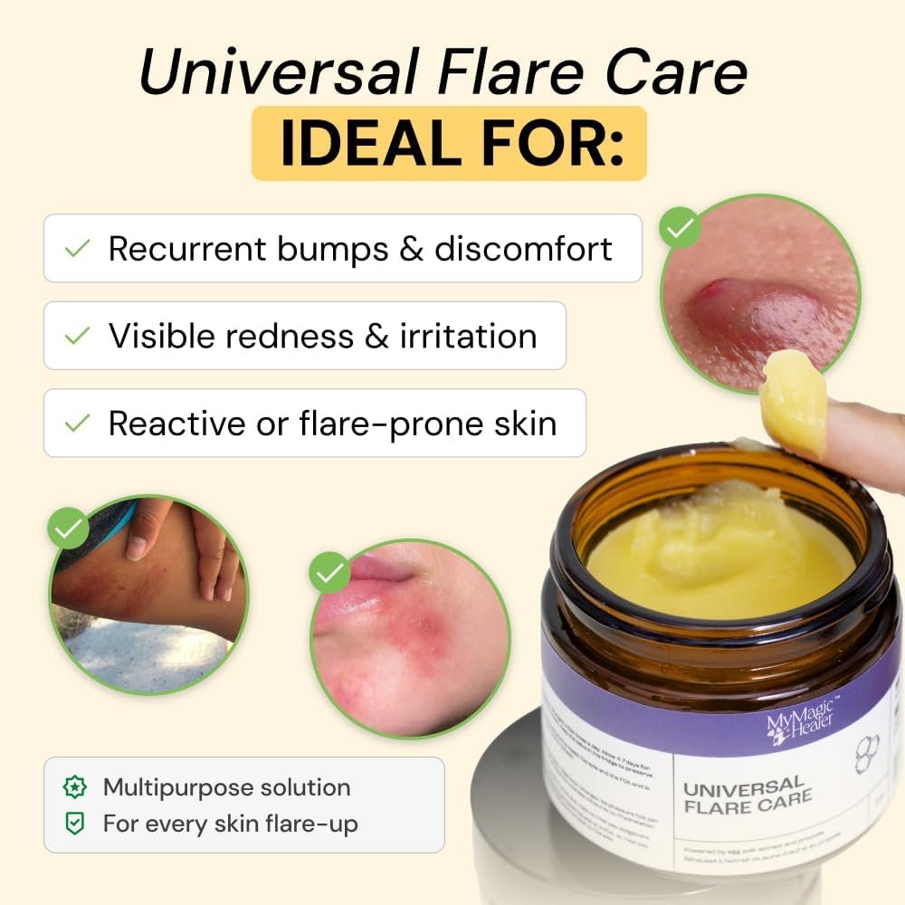 MyMagicHealer Universal Flare Care – Solution for Everyday Skin Flare-Ups | Drawing Salve for Boils & Cysts, Hidradenitis Suppurativa, Folliculitis | Irritated Skin and Chafing Relief 4 oz - Image 2