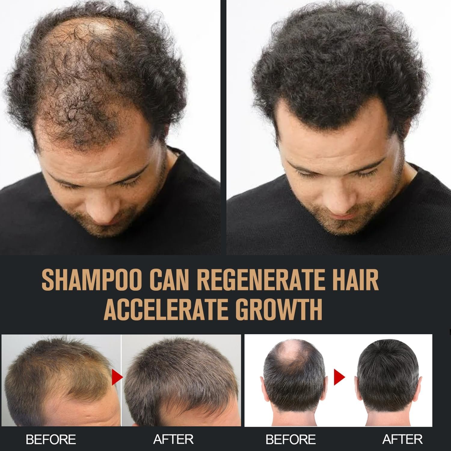 2 Pcs Root Activator Shampoo, Hair Growth Root Activator Shampoo, For Anti-Hair Loss, Natural Formula for Men and Women - Image 6