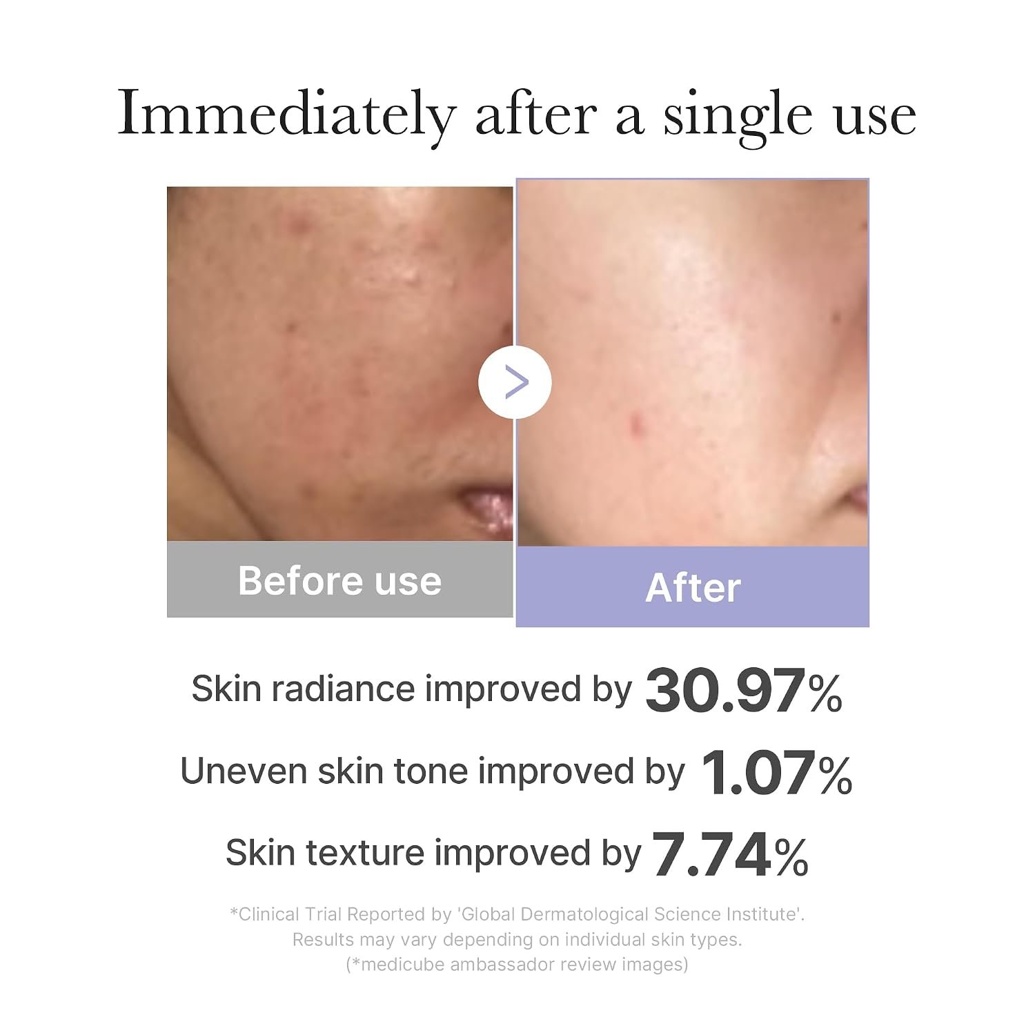 medicube Mini Booster Pro White | Affordable At-Home Facial Device for Beginners - Portable Glow Booster for Glass Skin, Boosting Skin Care Absorption, Skincare for Teens, Korean Skin Care - Image 3