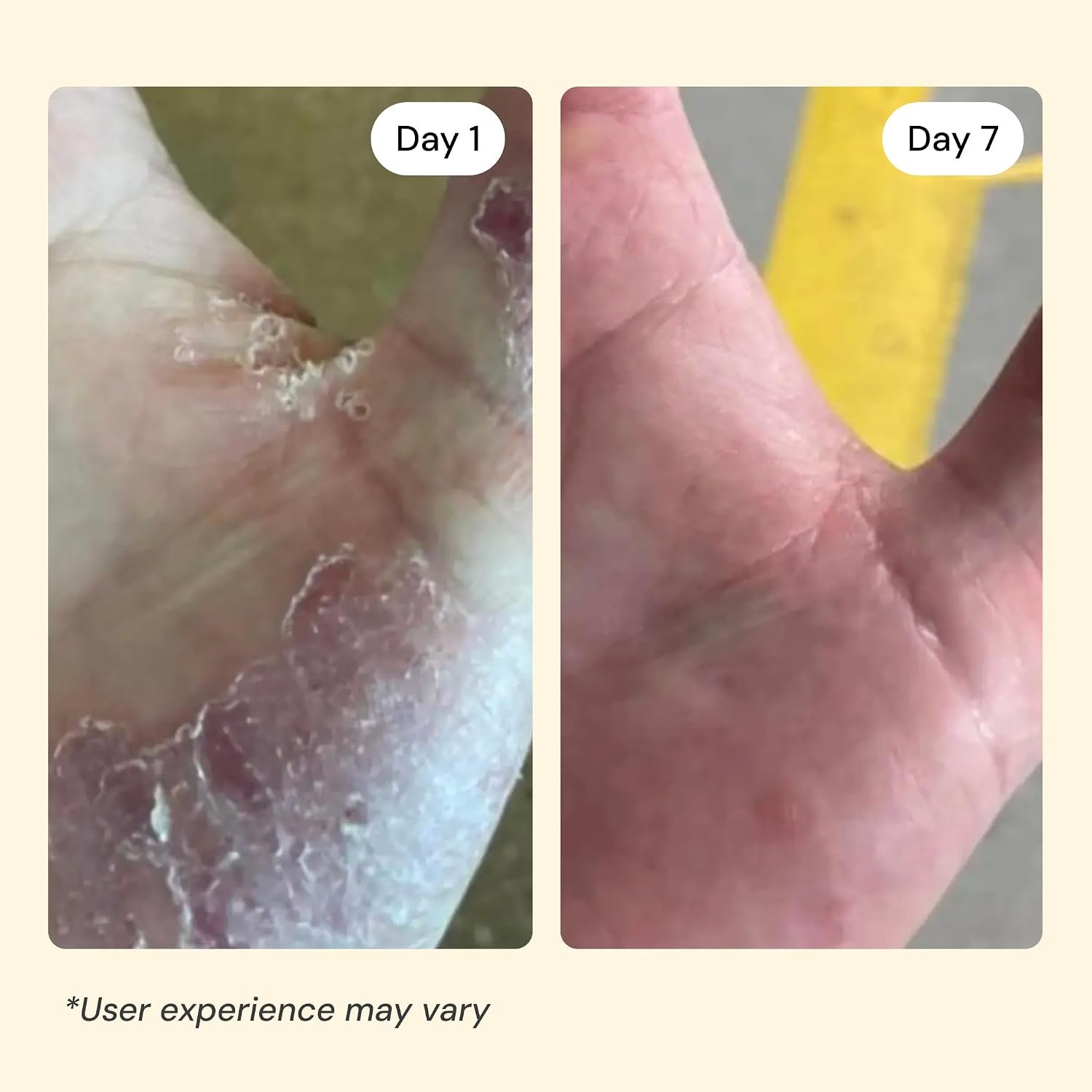 MyMagicHealer Universal Flare Care | Essential Oil Free | Baby Dermatitis, Diaper Rash, Eczema, Psoriasis, Impetigo | Wound Care | Multi-purpose Solution for Sensitive Skin w/ Propolis & Egg Yolk 4 oz - Image 5