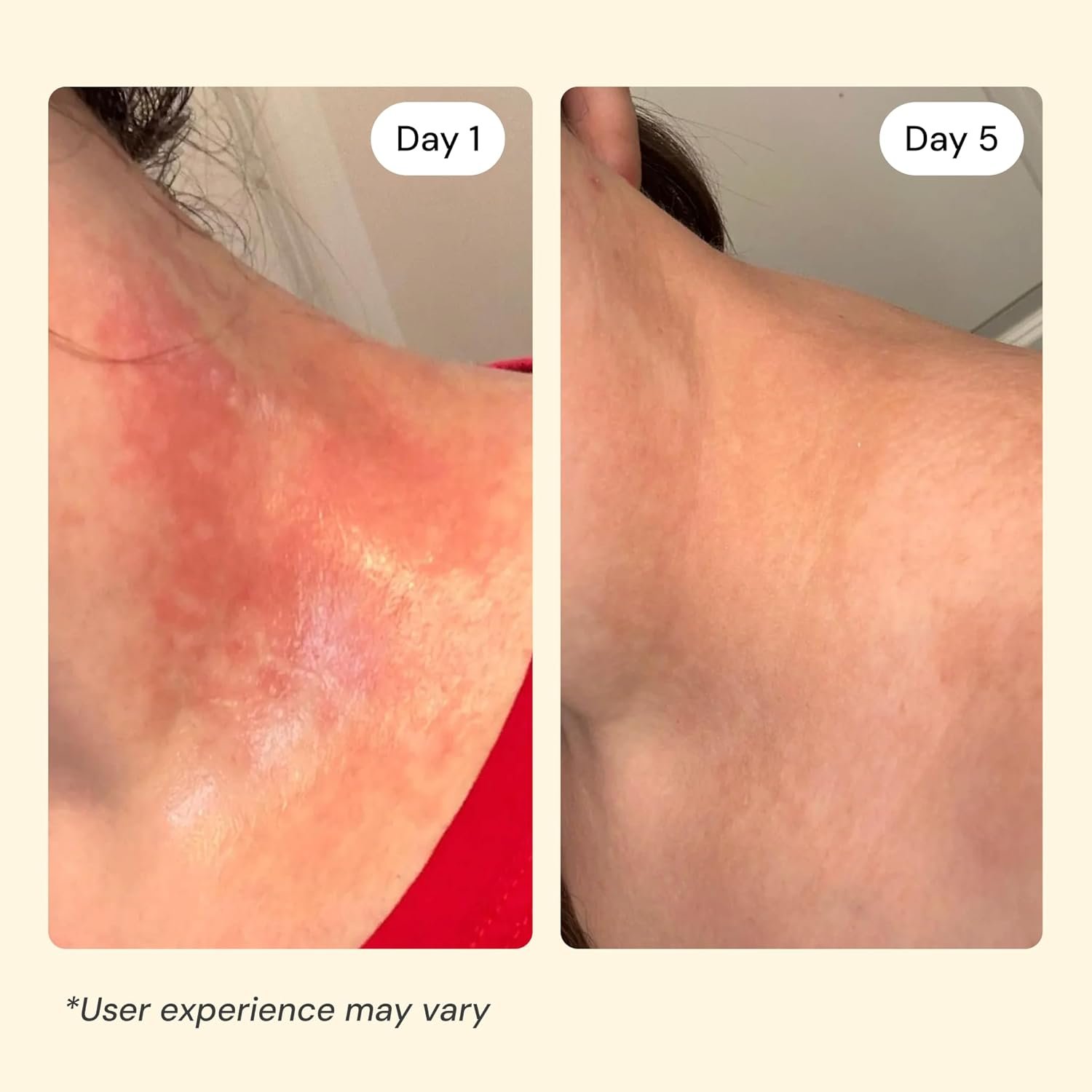 MyMagicHealer Universal Flare Care | Essential Oil Free | Baby Dermatitis, Diaper Rash, Eczema, Psoriasis, Impetigo | Wound Care | Multi-purpose Solution for Sensitive Skin w/ Propolis & Egg Yolk 4 oz - Image 3