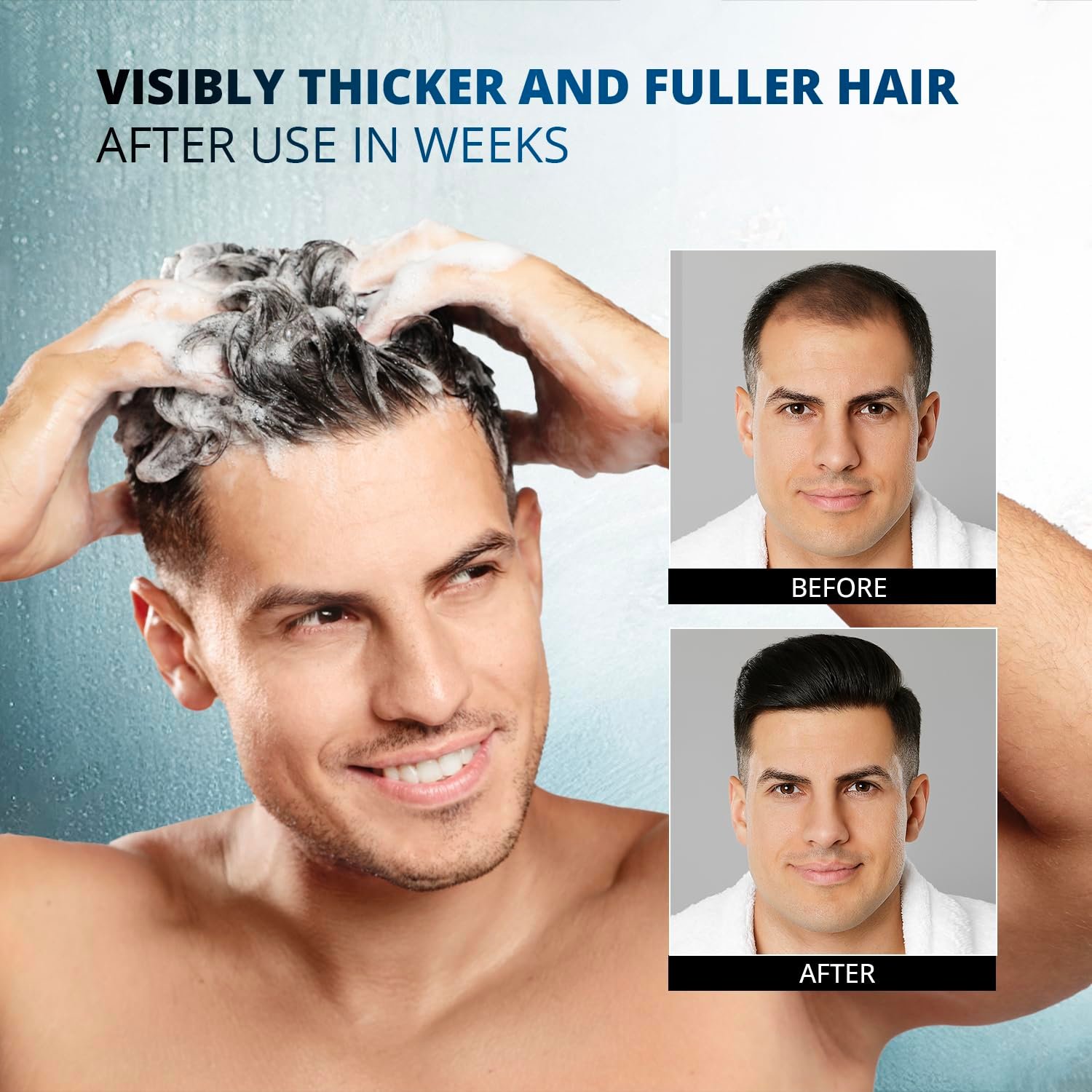 Root Activator Shampoo for Men - Hair Growth Shampoo for Hair Loss and Thinning Hair - Hair Loss RegrowthTreatments for Women Men (10.1 Fl Oz (Pack of 1)) - Image 2
