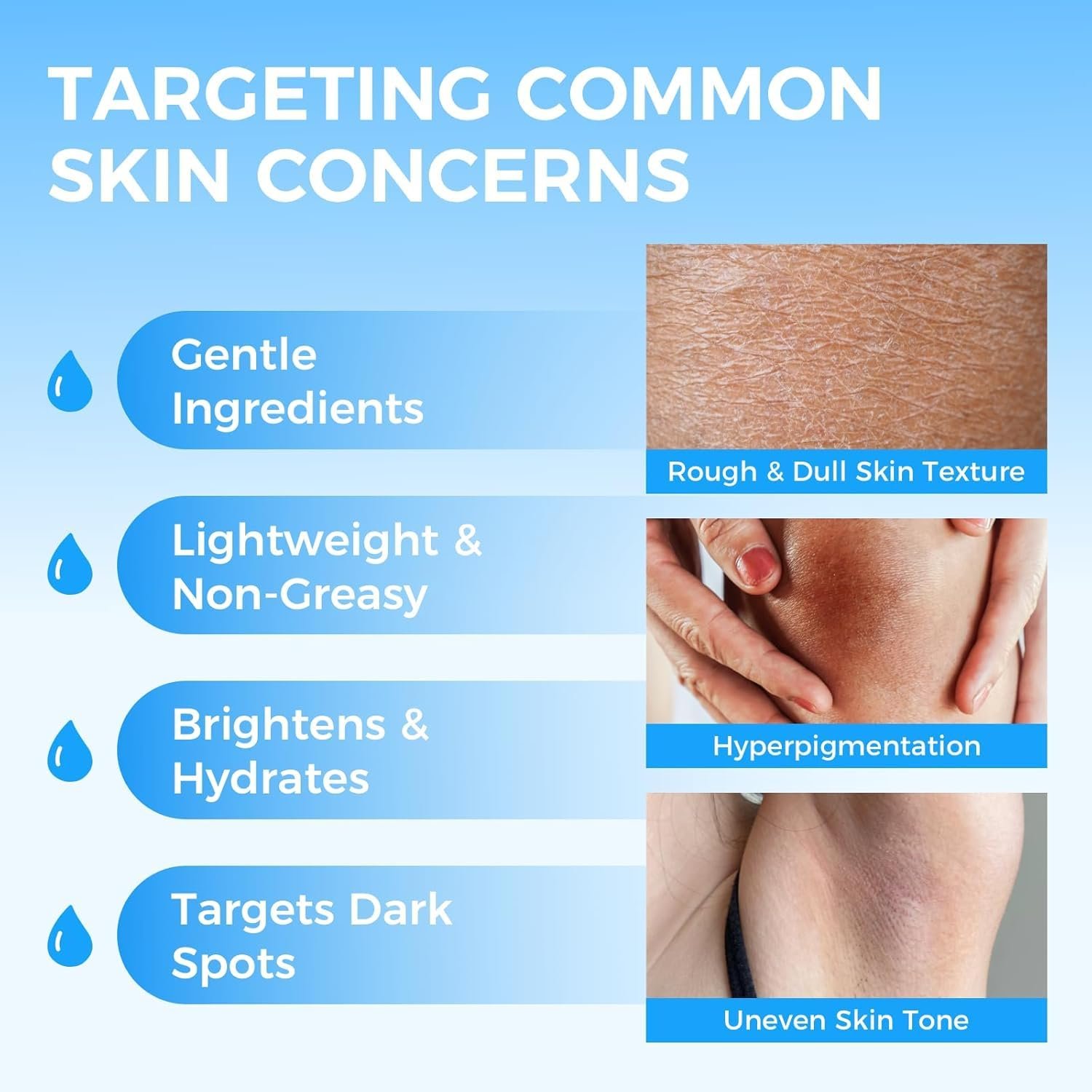 Skin Brightening Cream for Body – Dark Spot Corrector for Private Parts, Inner Thigh, Bikini Areas – Fades Hyperpigmentation & Uneven Skin Tone, Skin Lightening Cream for Underarms, Knees, 1.7 fl oz - Image 3