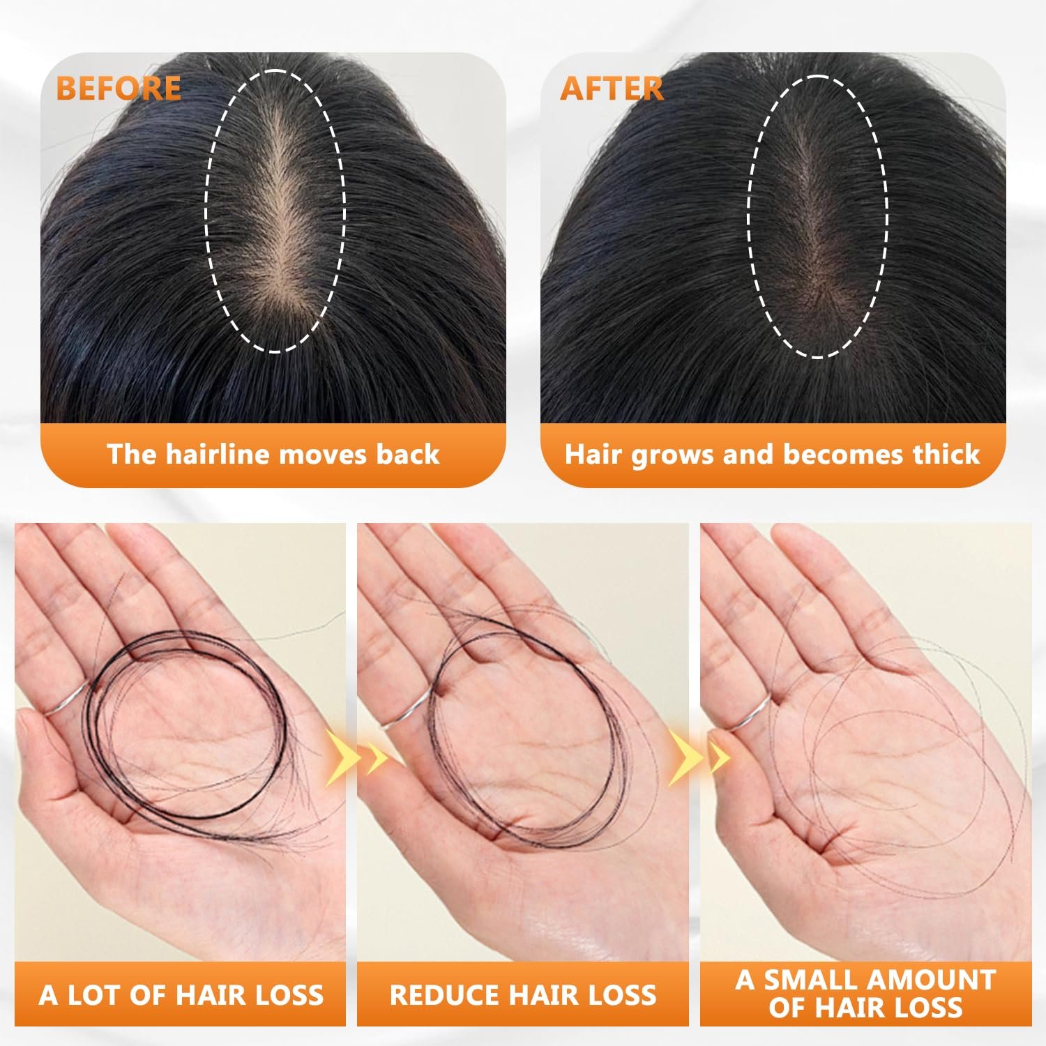 Wanban Anti Hair Loss Shampoo - Routine Shampoo for Women, Promotes Hair Growth (1pcs) - Image 3