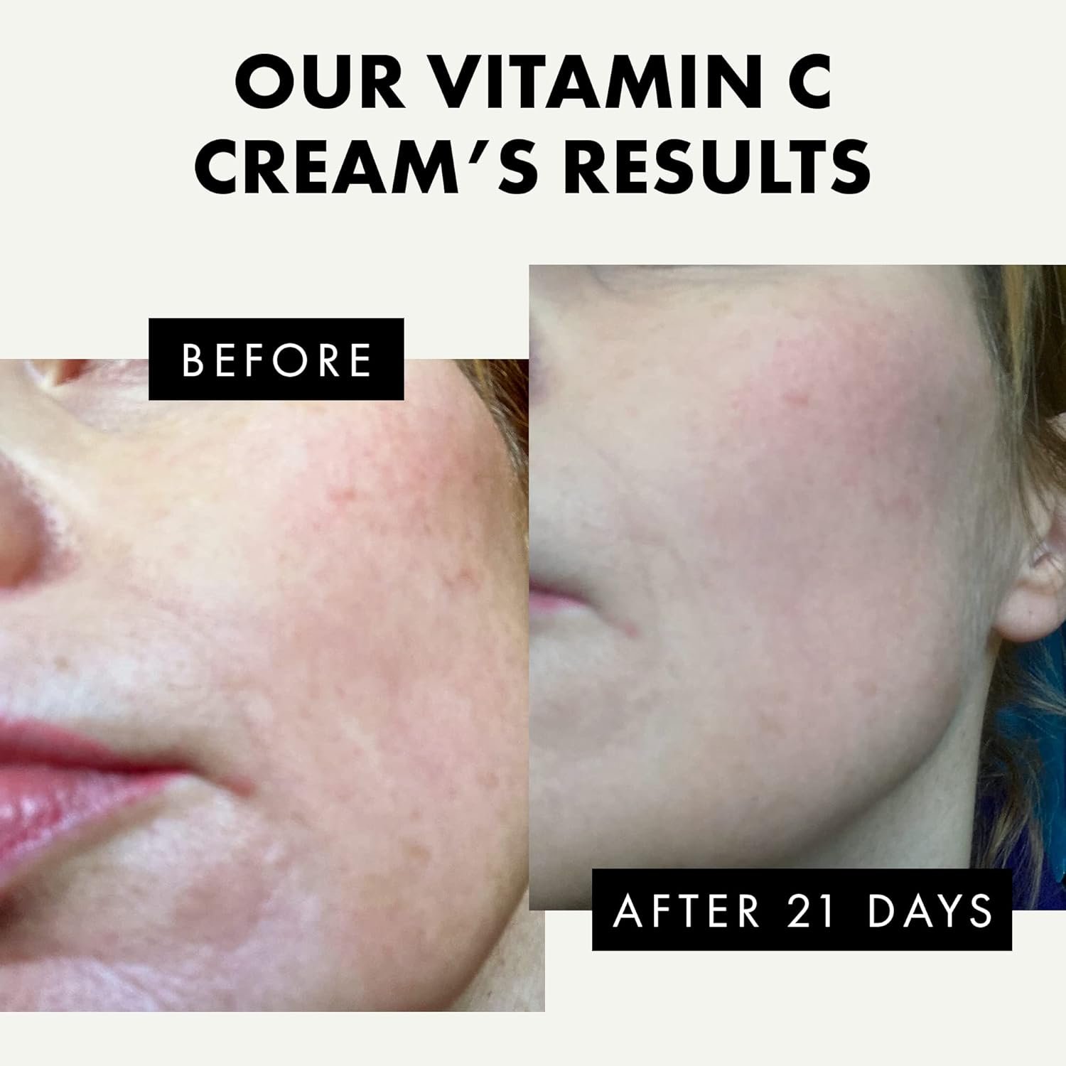 Eclat Skincare Vitamin C Moisturizer for Face with Hyaluronic Acid & Squalane - Face Brightening Cream - Anti Aging, Firming & Hydrating Vitamin C Cream for All Skin Tone 50 ml - Image 3