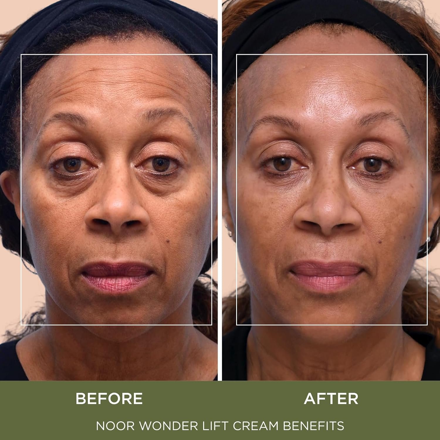 Noor Wonder Lift Cream for Women, Natural Anti-Aging Wrinkle teatment with Syn-Ake natural blend Promotes Anti Aging and Significantly Less Wrinkles In As Little As A Few Days - Image 3