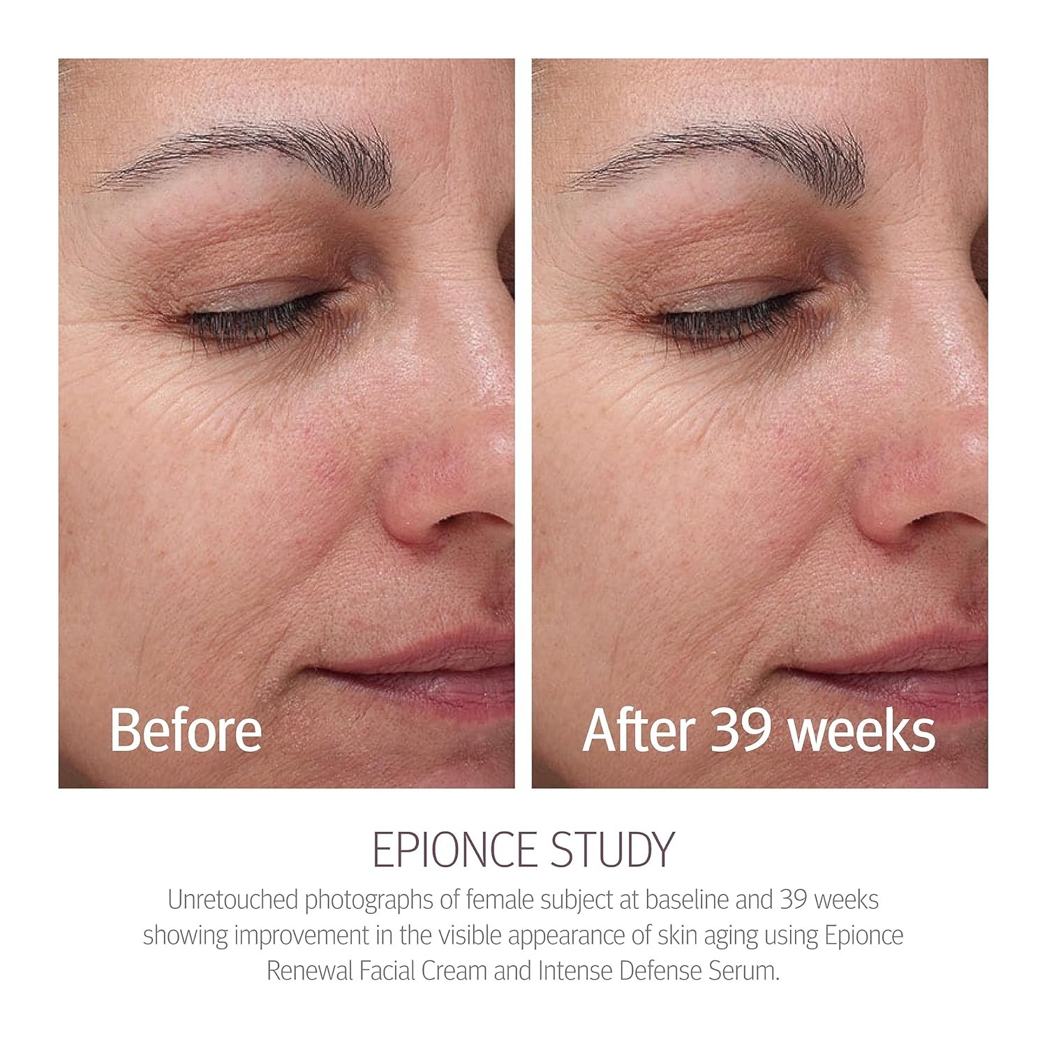 Epionce Renewal Facial Cream – Hydrating Anti-Aging Moisturizer | For Dry, Sensitive to Normal Skin | Fine Lines & Wrinkles | Dermatologist Skincare - Image 9