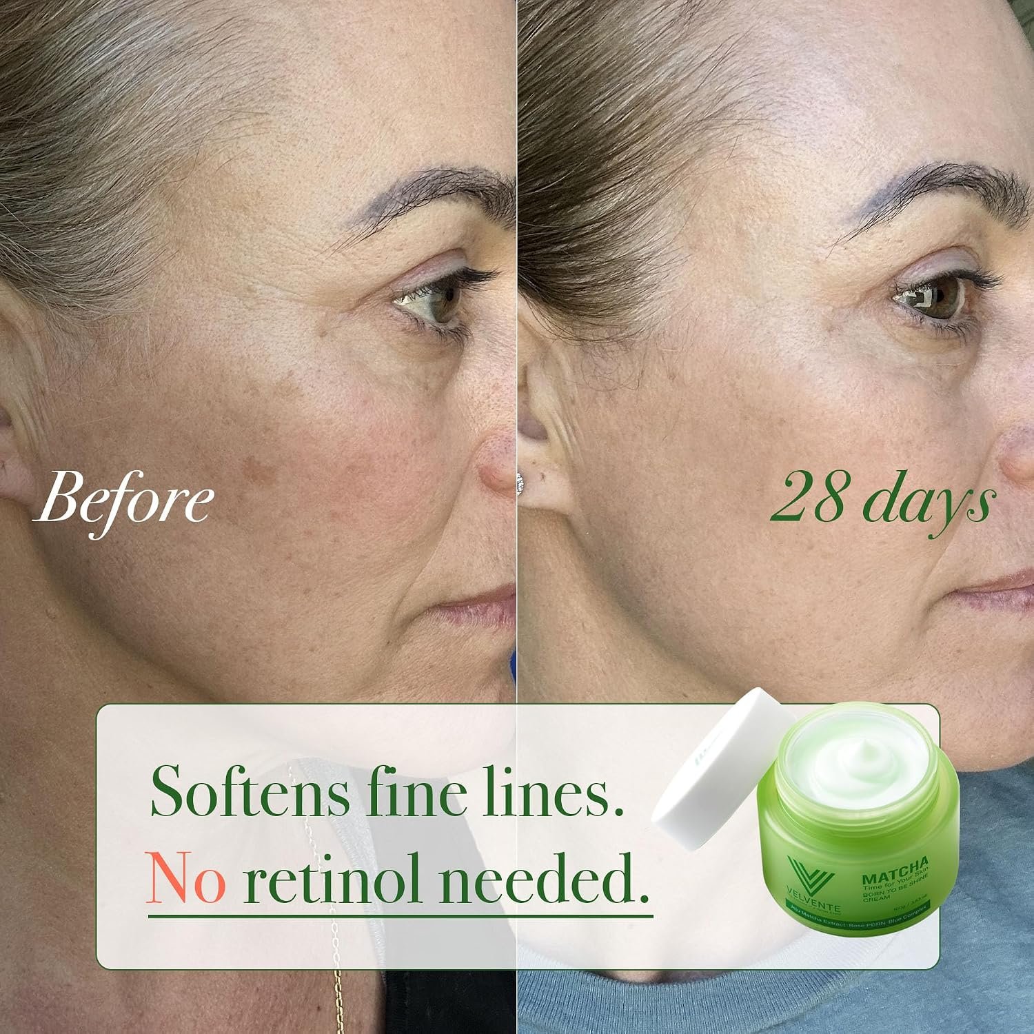 Matcha Anti Aging Face Cream Rose PDRN, Korean Hydrating Firming Facial Moisturizer to Reduce Wrinkles, Soothing Radiance, Glowy Skin, Day & Night Cream for All Skin Types,3.53 oz - Image 4
