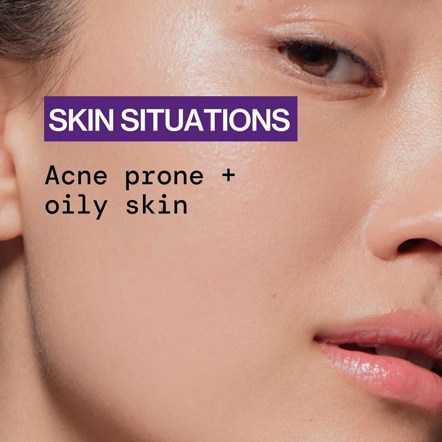 Pacifica Acne Spot Treatment & Pimple Cream – Dry It Out Gel with 2% Salicylic Acid, Witch Hazel, Niacinamide – Dries Blemishes Overnight, Fights Breakouts & Redness, For Teens & Adults, Vegan Clean - Image 7
