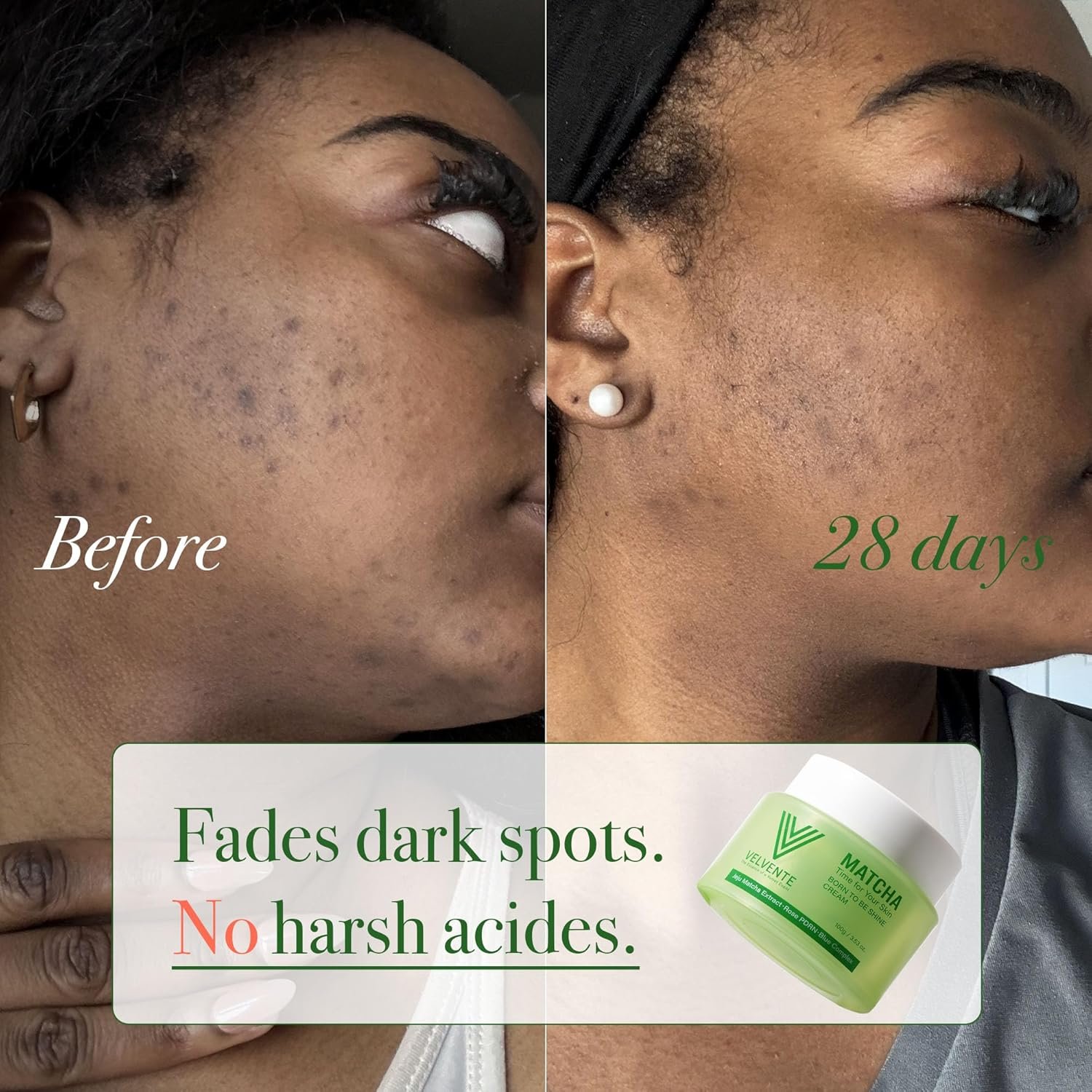 Matcha Anti Aging Face Cream Rose PDRN, Korean Hydrating Firming Facial Moisturizer to Reduce Wrinkles, Soothing Radiance, Glowy Skin, Day & Night Cream for All Skin Types,3.53 oz - Image 5