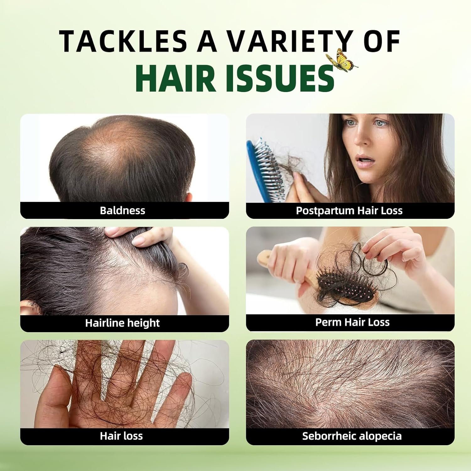 Rosemary Hair Growth Shampoo and Conditioner Set: Thickness & Anti Hair Loss Shampoo and Conditioner with Tea Tree Oil Mint Biotin – Strengthening Formula for Men & Women, Thinning & Damaged Hair Care - Image 4