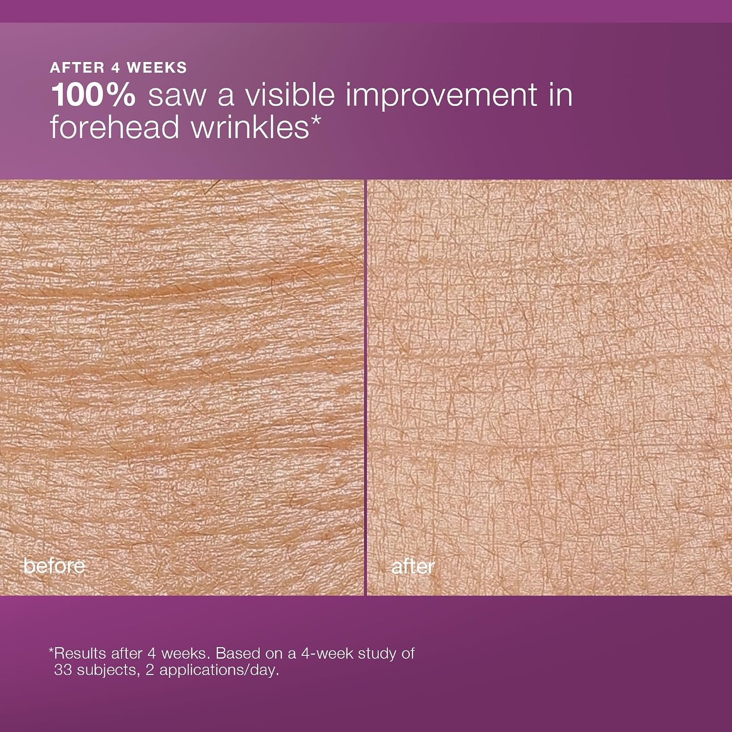 Dermalogica MultiVitamin Power Recovery Face Cream, Hydrating Facial Moisturizer with Antioxidants - Preventing Signs of Skin Aging, 1.7 fl oz - Image 6