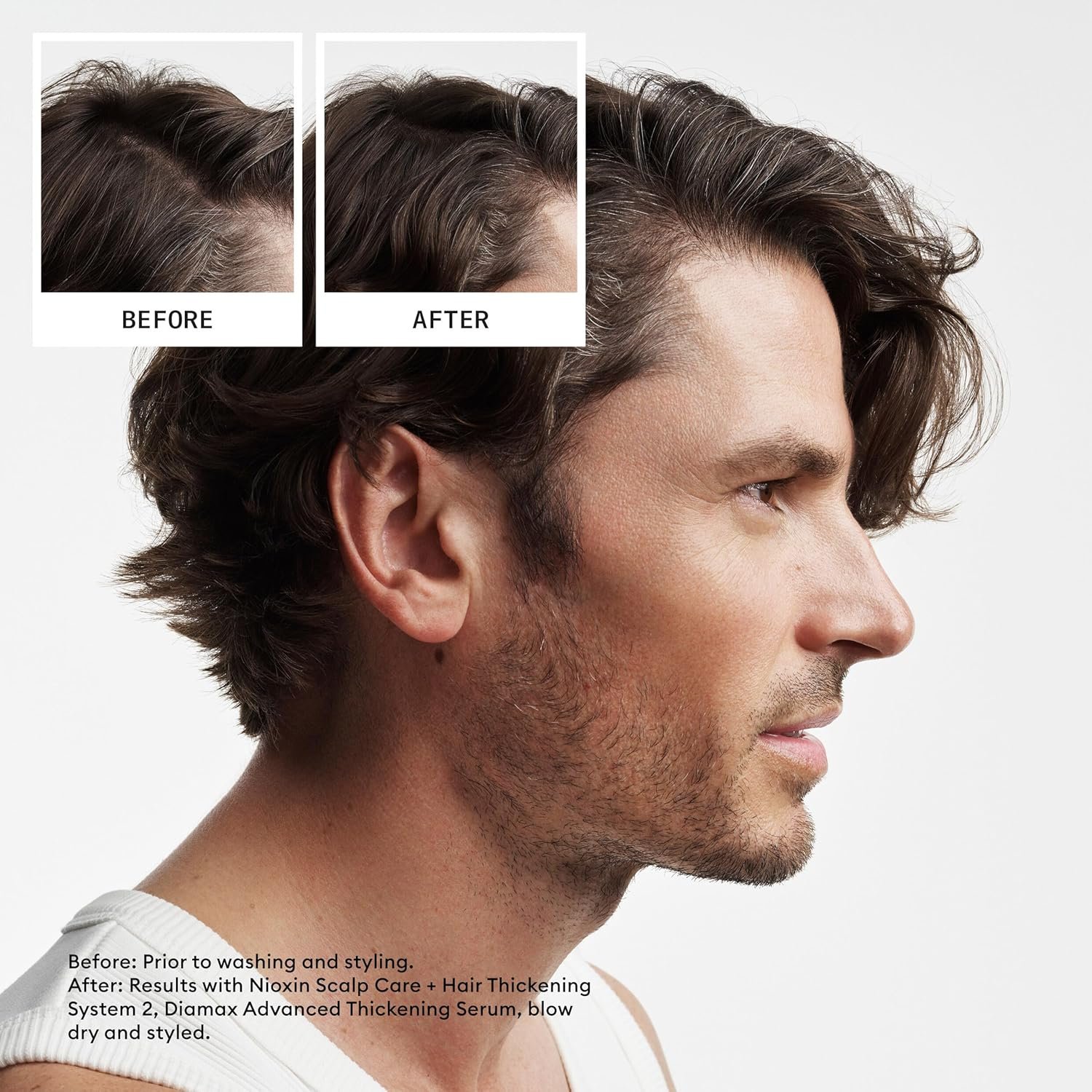 Nioxin Scalp + Hair Thickening System Kits | For Natural, Colored, & Damaged Hair with Light to Progressed Thinning | Strengthen & Boost Hair Density with Niacinamide & Biotin | 3 Month Supply - Image 2
